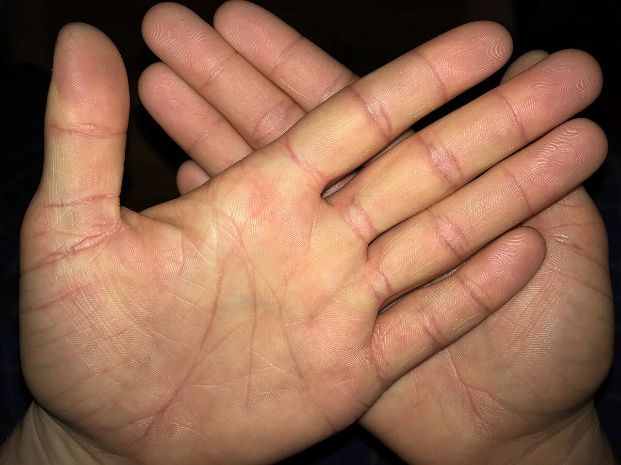 An open pair of hands showing the palms and fingers
